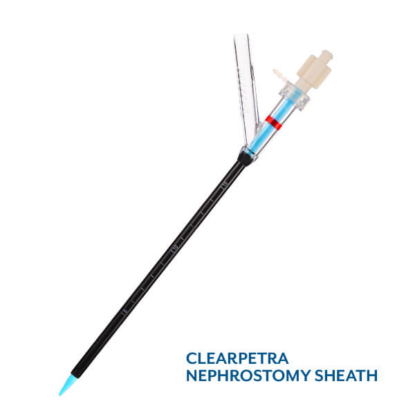 Clearpetra Nephrostomy Sheath